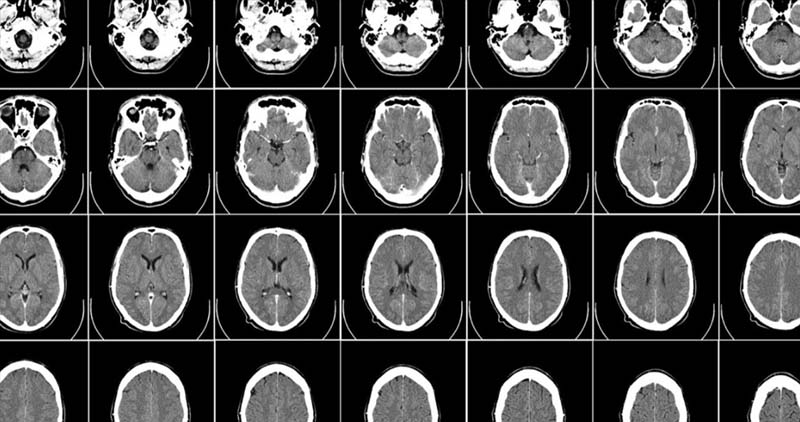 영국 AI센터, 엔비디아 슈퍼컴퓨터로 10만 합성 뇌 이미지 생성 나선다 영국 AI센터, 엔비디아 슈퍼컴퓨터로 10만 합성 뇌 이미지 생성 나선다